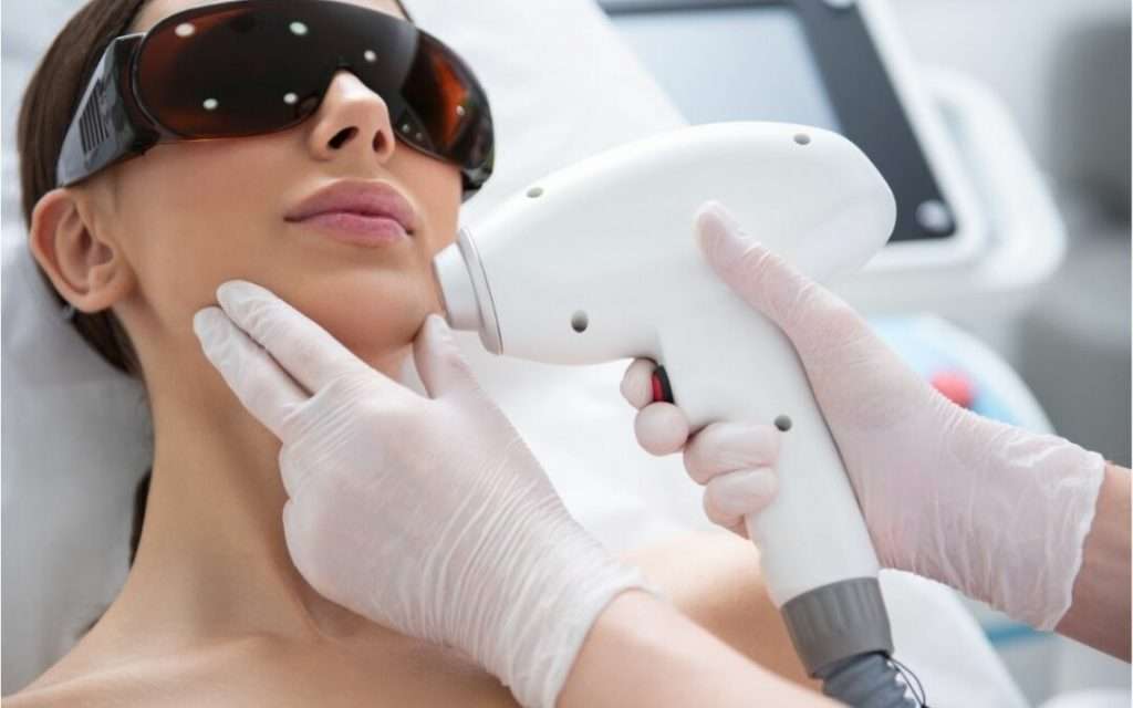 laser-facial-hair-removal-Royal Med Spa